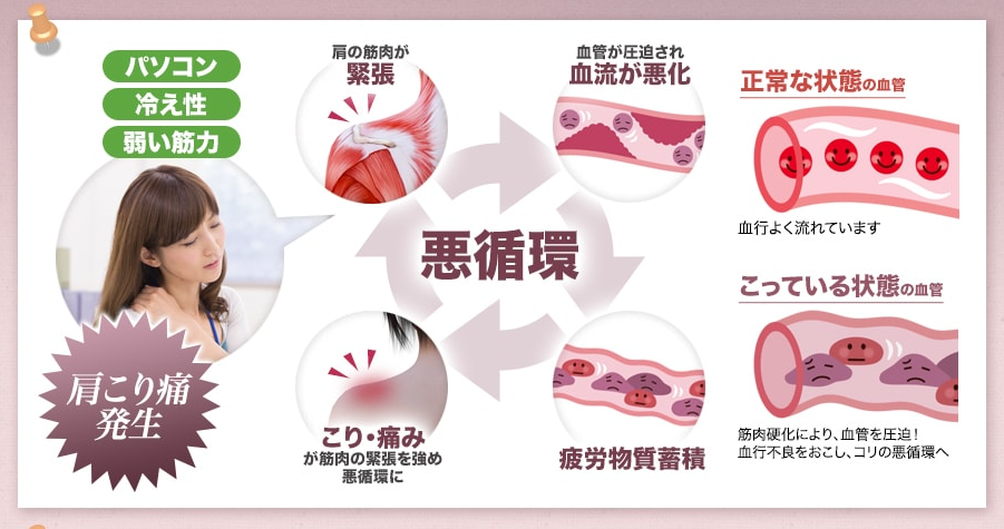 辛い肩こり.冷え性.首筋の痛み.目の疲れ.頭痛.最安値.効果